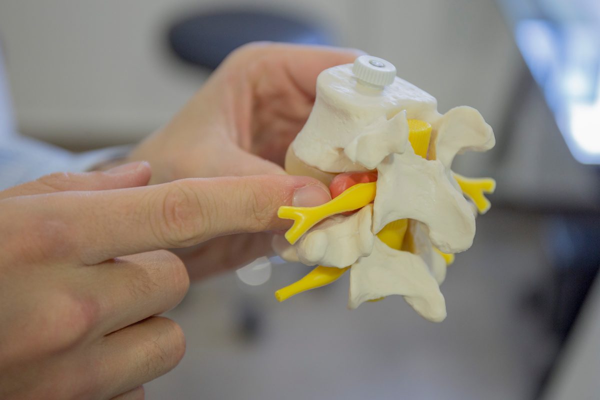 ¿Qué son los dermatomas cervicales?